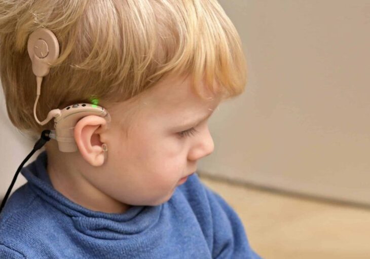 Cochlear Implants